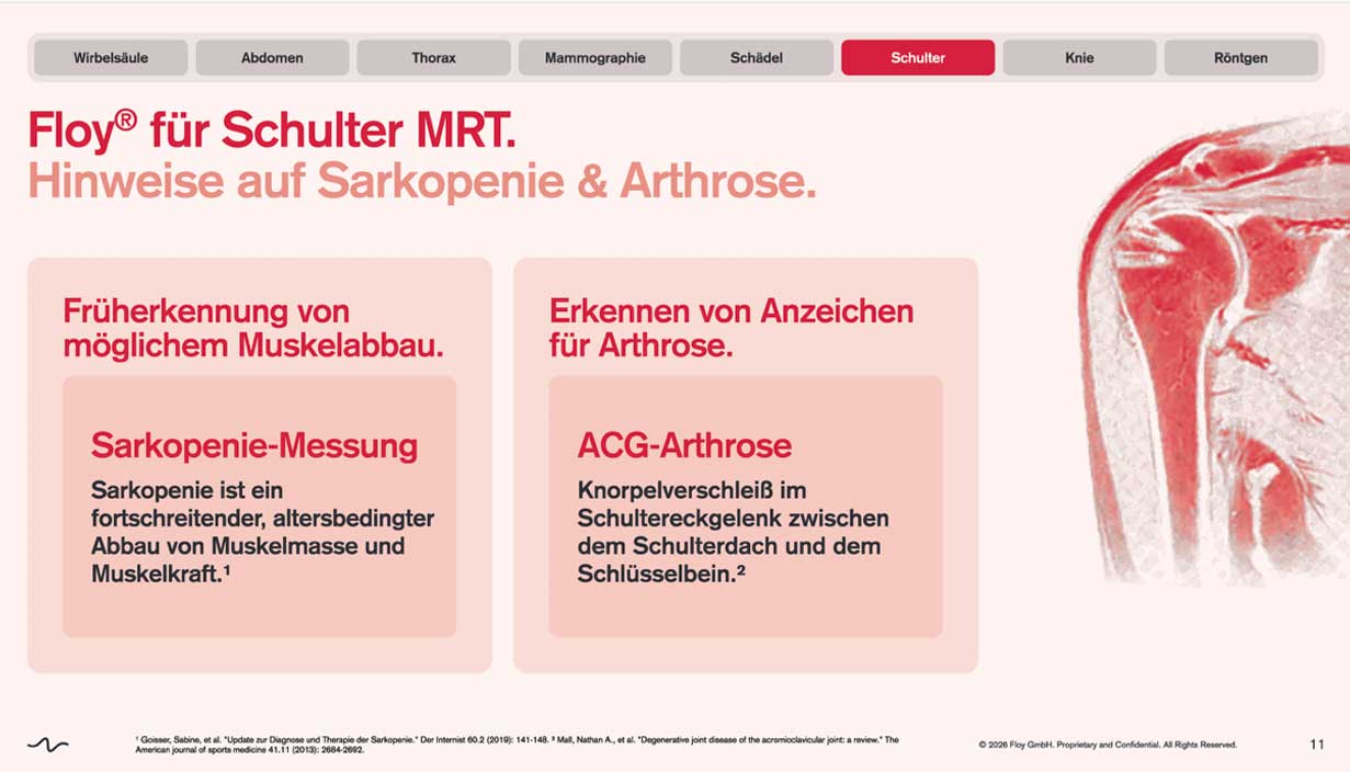 radiologie-am-theater-paderborn-floy-schulter