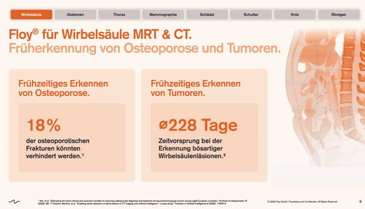 radiologie-am-theater-paderborn-floy-wirbelsaeule